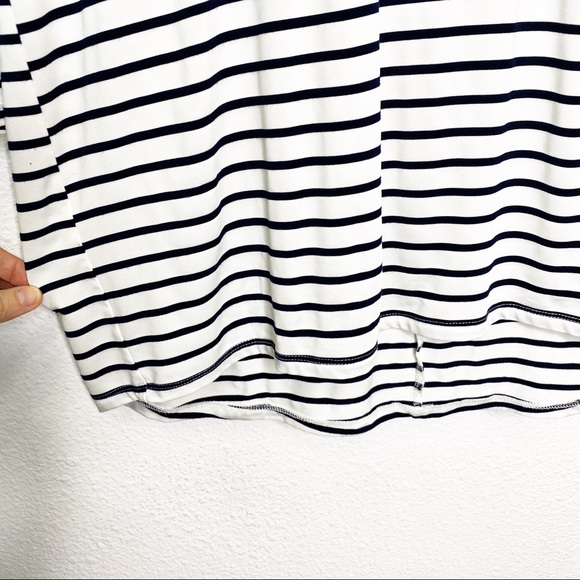 HYFVE Oversized Striped Tunic Dress - Picture 3 of 6
